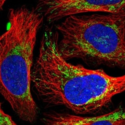 EVC2 Antibody, Novus Biologicals 0.1mL; Unlabeled:Antibodies, Polyclonal
